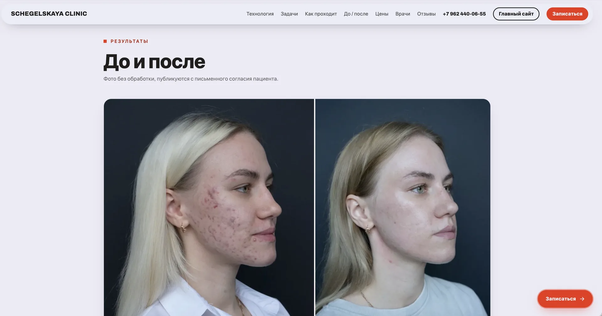Лендинг PLADUO: блок «до и после»