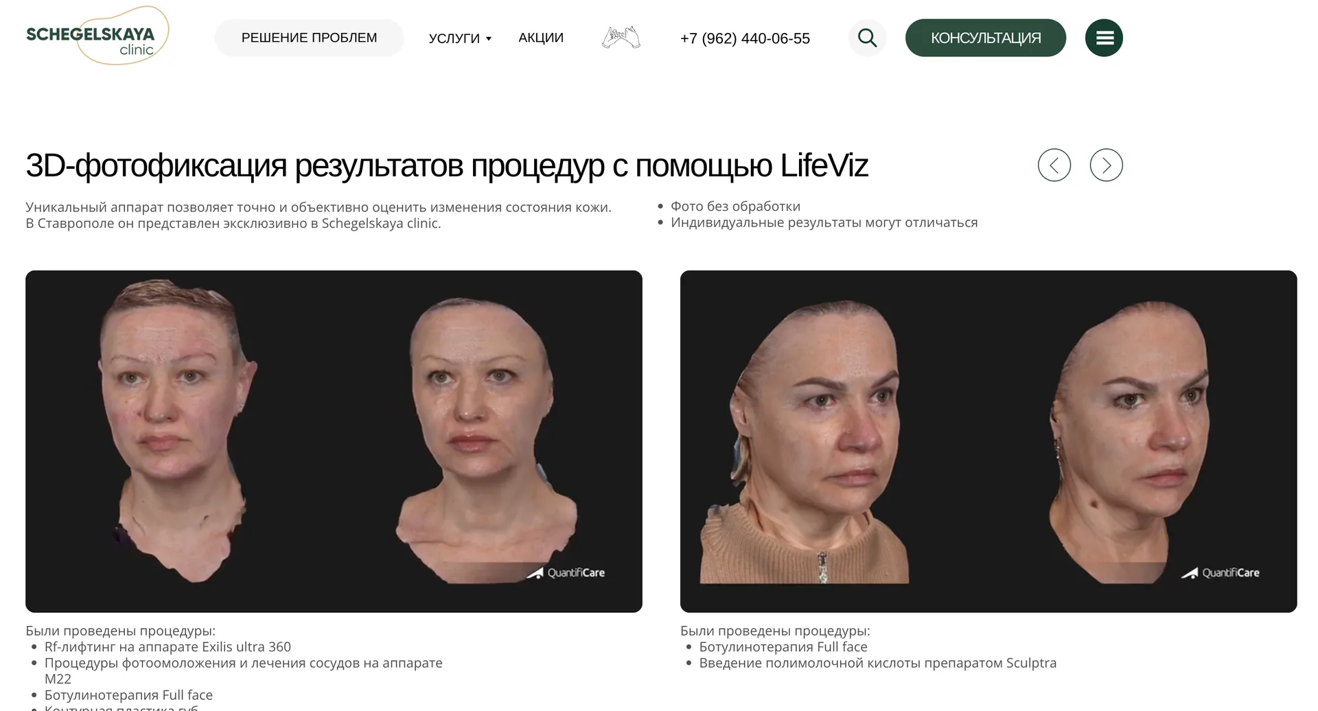 3D-фотофиксация результатов процедур LifeViz